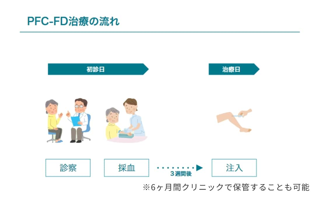 PFC-FD治療の流れ
